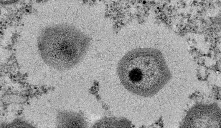 A transmission electron micrograph of mimivirus particles.