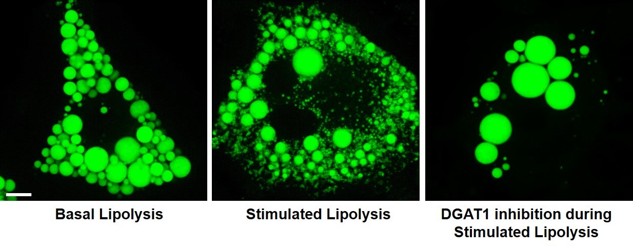 Images of Basal Lipolysis, Stimulated Lipolysis, and DGAT1 inhibition during Stimulated Liplysis
