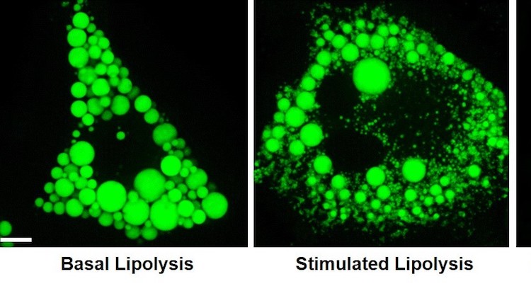 Images of Basal Lipolysis, Stimulated Lipolysis, and DGAT1 inhibition during Stimulated Liplysis