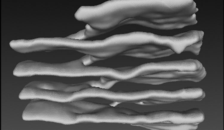 Rapoport Lab unveils how endoplasmic reticulum stacks are connected ...
